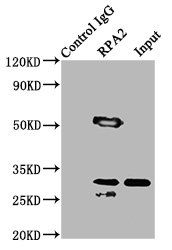 Replication protein A 32 kDa subunit antibody