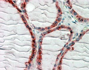 Goat anti-Restin / CLIP1 Antibody
