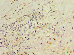 RET Antibody
