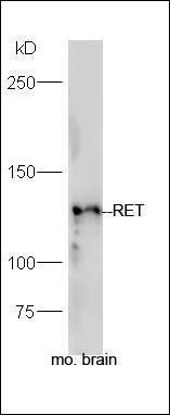 RET antibody