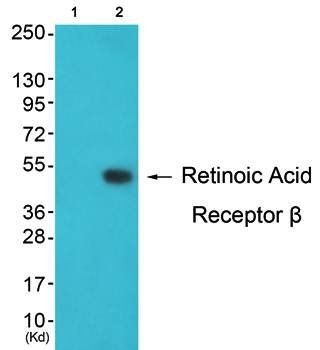 Retinoic Acid Receptor β Antibody