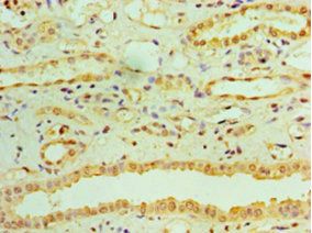 RDH11 Antibody