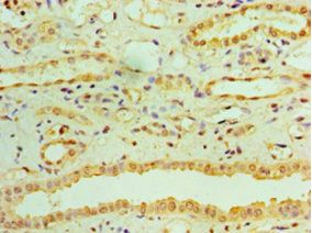 Retinol dehydrogenase 11 antibody