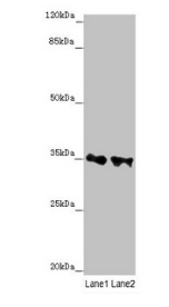 Retinol dehydrogenase 11 antibody