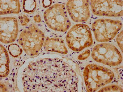 REV1 Antibody