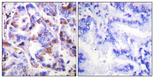 BIRC2 antibody