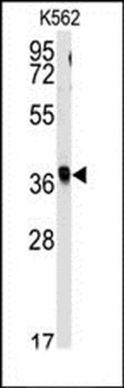 RFC2 antibody