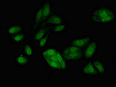 RFC4 antibody