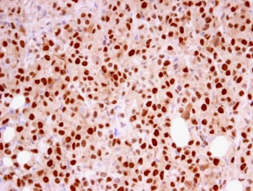 RFC4 antibody