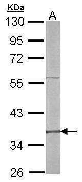 RFC4 antibody