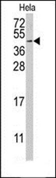 RFC5 antibody