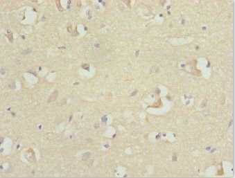 RFPL2 Antibody