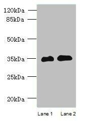 RFPL3 Antibody