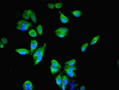 RFTN2 Antibody