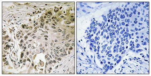RFX2 Antibody