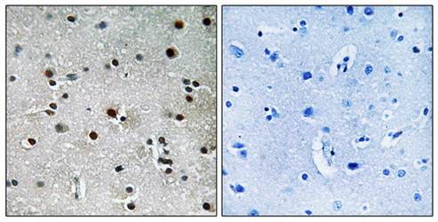 RFX3 Antibody
