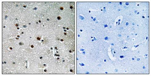 RFX3 antibody