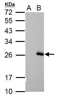 RGS17 antibody