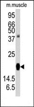 RGS19 antibody
