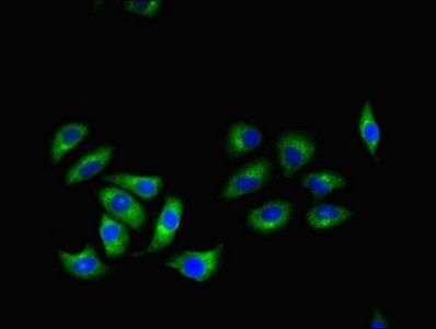 RGS2 Antibody