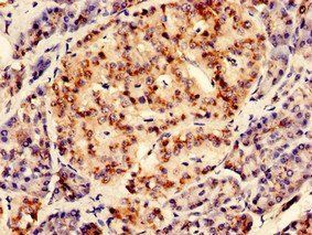 RGS2 Antibody
