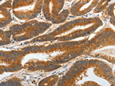 RGS2 Antibody