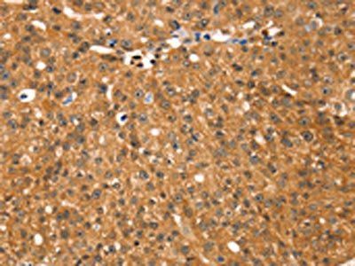 RGS22 Antibody