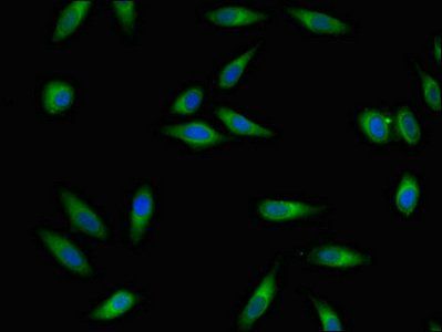 RGS4 Antibody