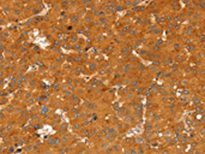 RGS4 Antibody