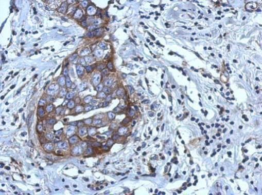 RGS4 antibody