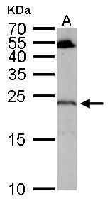 regulator of G protein signaling 4 Antibody