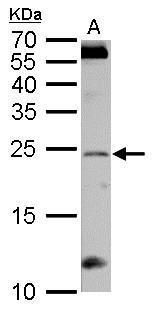 RGS4 antibody