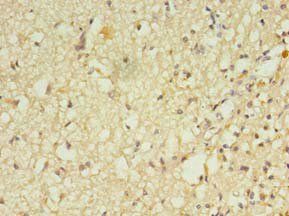 RGS7 Antibody