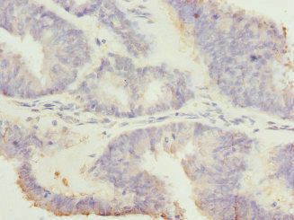 RGS7 Antibody