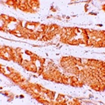 RHAMM Rabbit Polyclonal Antibody