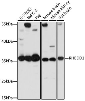 RHBDD1 antibody