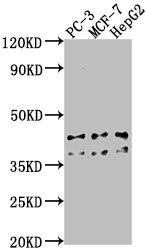 RHBDD3 antibody