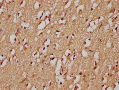 RHBDF1 Antibody