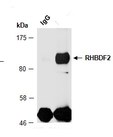 RHBDF2 (N1) Antibody, Rabbit Polyclonal