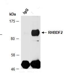 RHBDF2 antibody