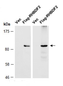 RHBDF2 (N1) Antibody, Rabbit Polyclonal