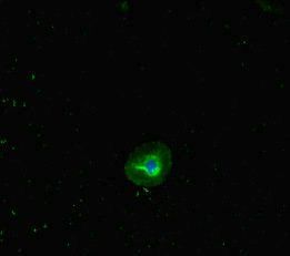 RHD Antibody