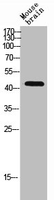 RHD antibody