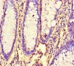 RHEB antibody