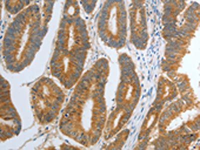 RHEB Antibody