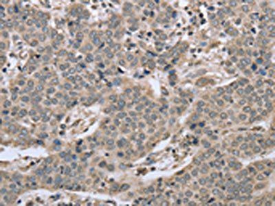 RHEB Antibody