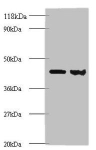 Rho GDP-dissociation inhibitor 1 antibody