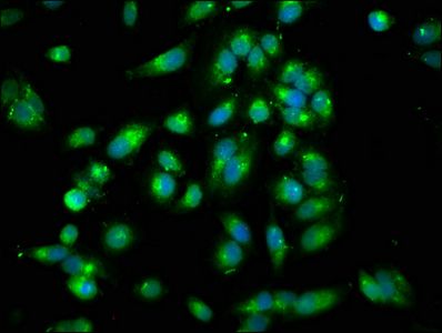 ARHGEF7 Antibody