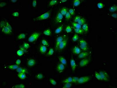 Rho guanine nucleotide exchange factor 7 antibody