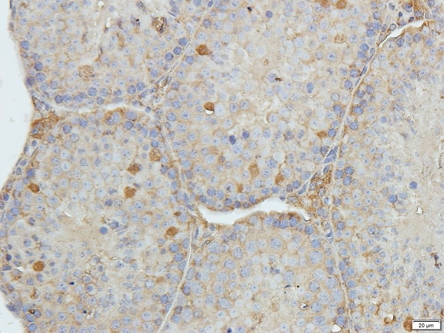 Rho guanine nucleotide exchange factor 7 antibody